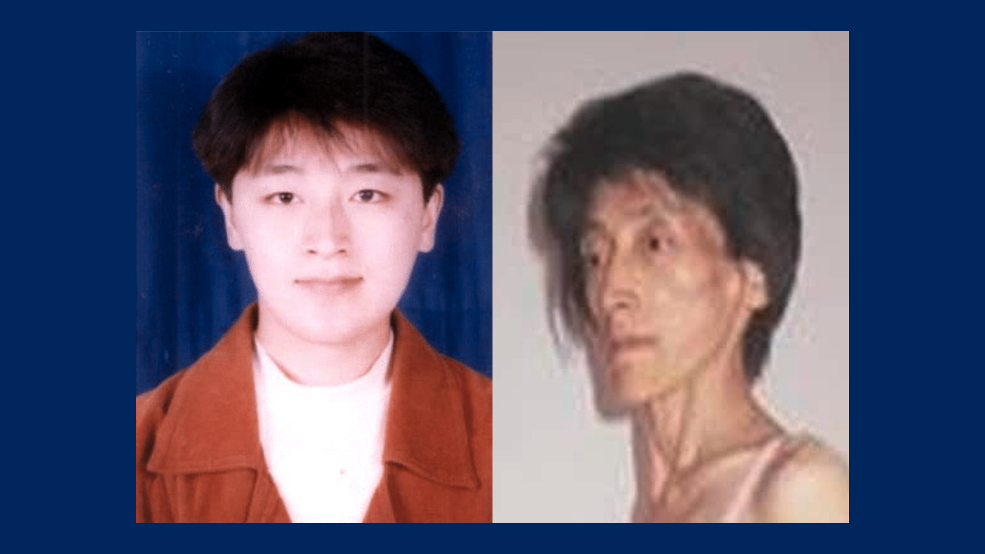 Ms. Song Yanqun with a healthy appearance before (left) and emancipated complexion after enduring 12 years of torture (right). 